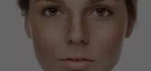 Skin Conditions Treatment