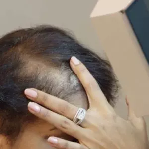Hair Analysis